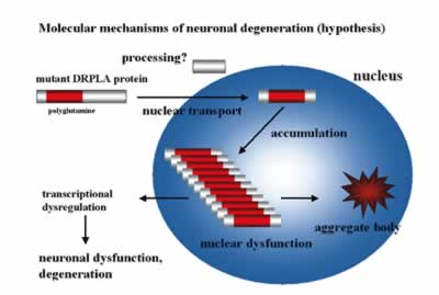 Molecular mechanisms of neuronal degeneration (hypothesis)