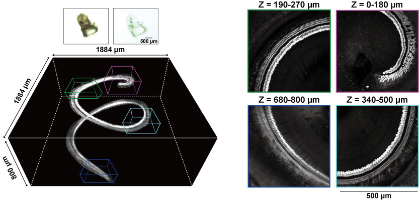 An analysis of cochlear sensory epithelium by using tissue clearing