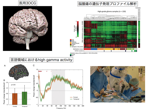 脳神経外科学 | 東京大学 大学院医学系研究科 脳神経医学専攻